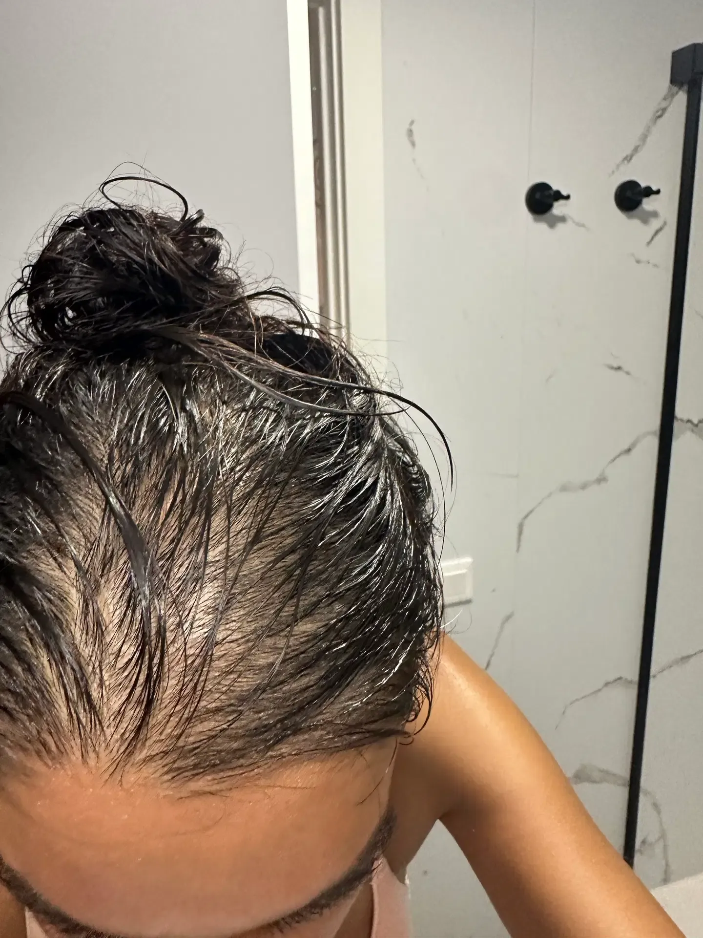 Before: customer-submitted overhead photograph of hair and scalp
