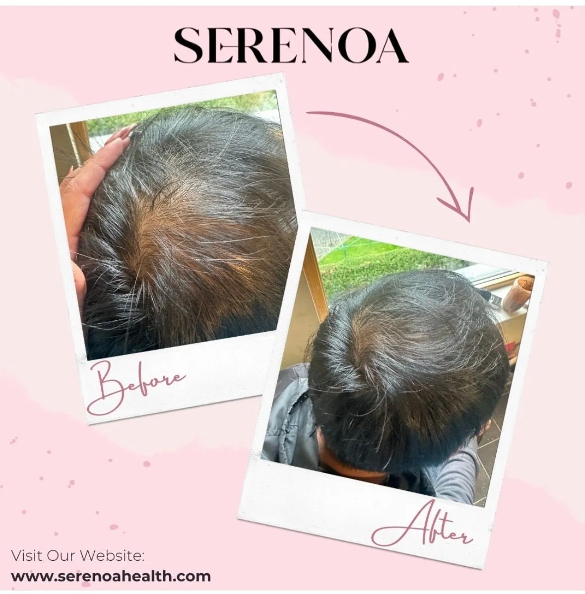 Customer-submitted before and after photos showing an individual crown progress journey