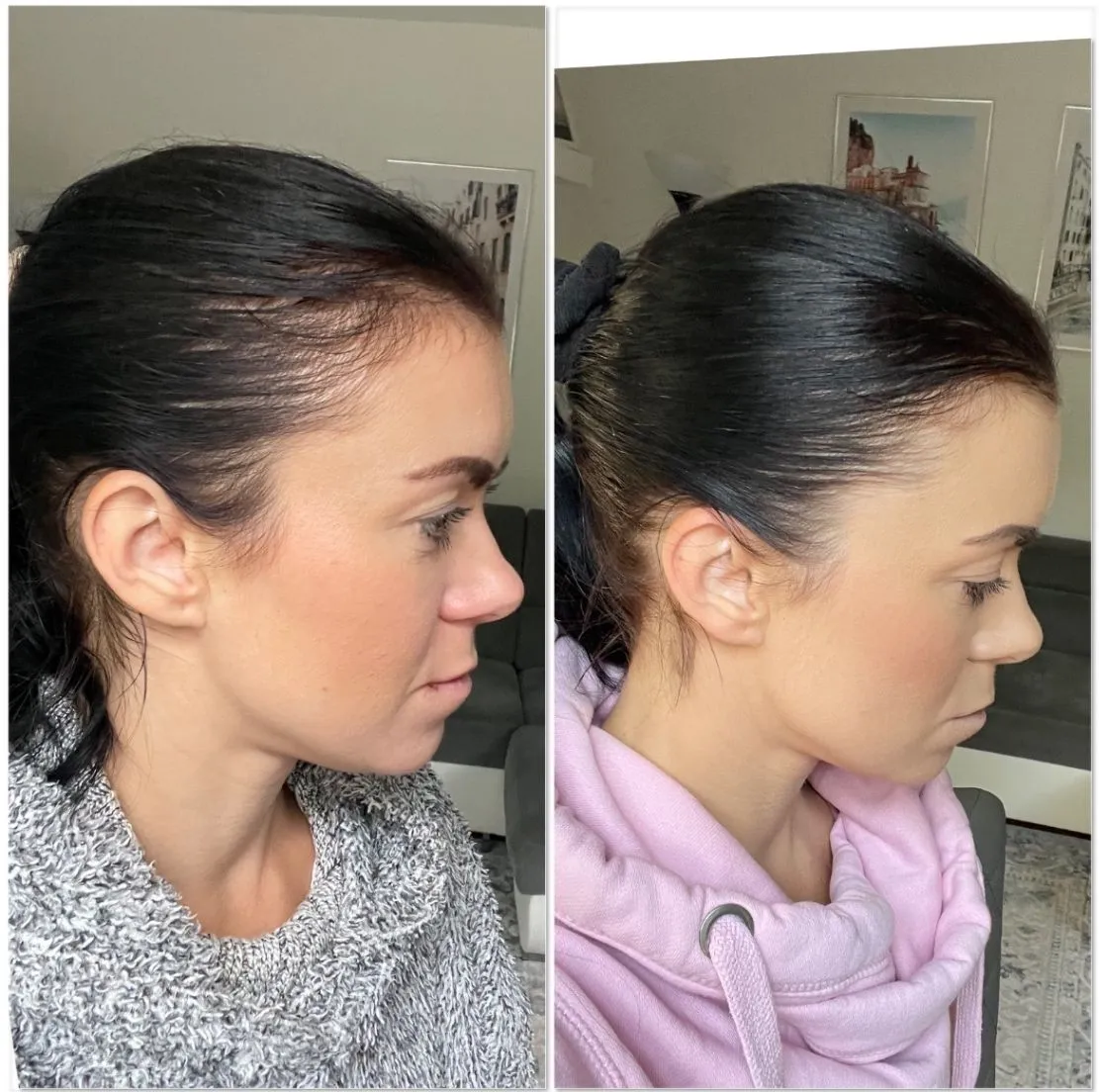 Customer-submitted side-by-side photos documenting an individual hair progress journey